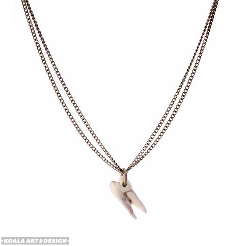 Molar Necklace