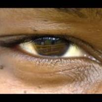 Eye_medium